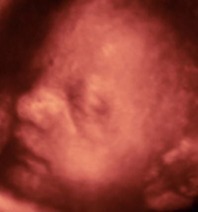 Pregnancy Ultrasound Image